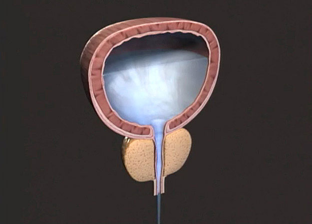 Bladder and prostate